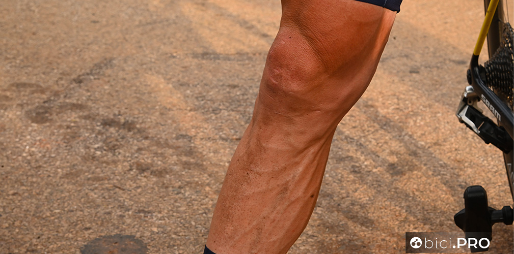 Campionato del mondo Kigali 2025, prova su strada professionisti, la gamba di Ciccone con le vene