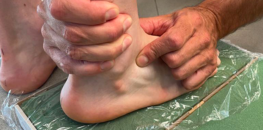 Plantari custom, fanno tanta differenza? Risponde il Dottor Carrara