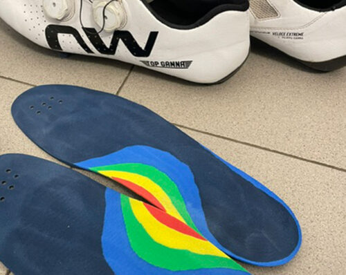 Plantari custom, fanno tanta differenza? Risponde il Dottor Carrara