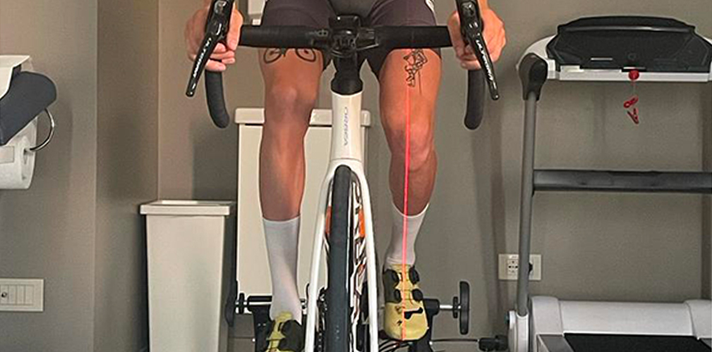 Plantari custom, fanno tanta differenza? Risponde il Dottor Carrara