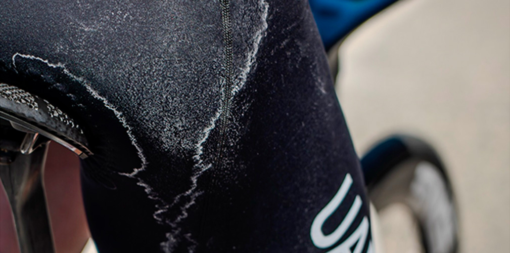 La perdita del sodio è soggettiva, ma resta uno dei tempi più delicati