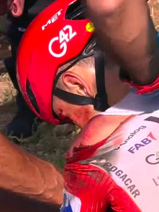 Pogacar stava bevendo quando ha perso l'equilibrio ed è caduto a peso morto. La spalla sinistra era dolorante (immagini Eurosport)